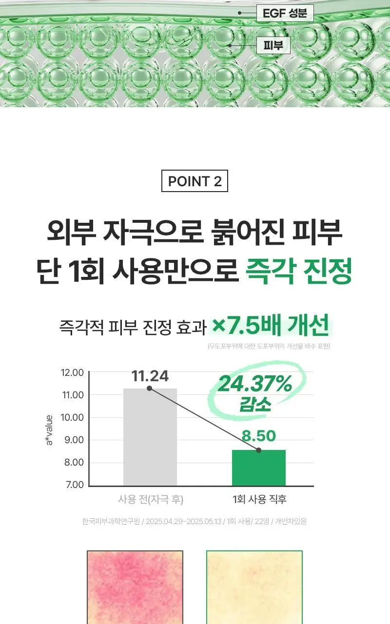[장벽탄력/속건조] 지피덤 셀트리온EGF 스킨베리어 하이드레이팅 수분크림 80ml 상세페이지 21